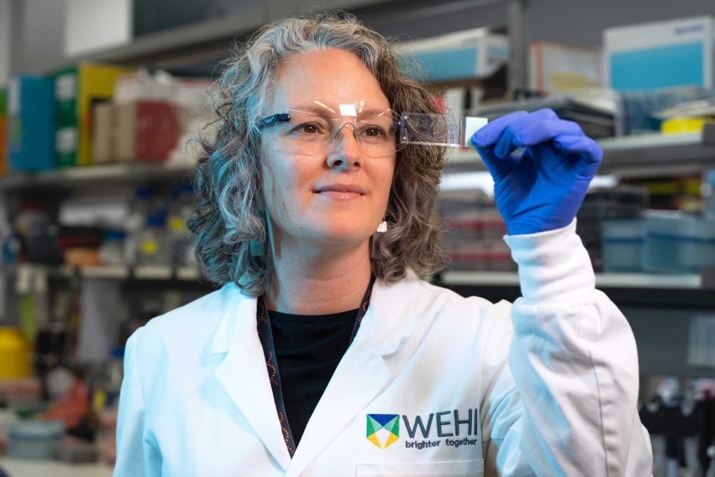Prader-Willi syndrome cells study revives silent genes